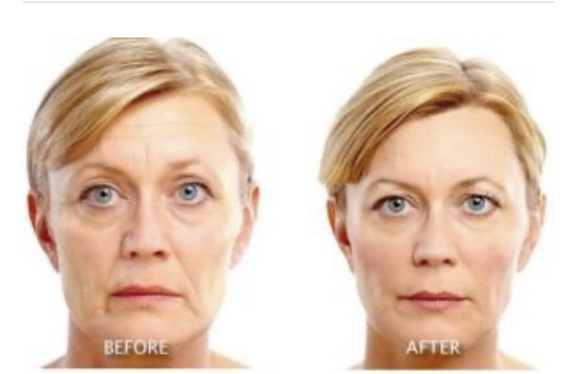 Age maintenance London U.K. 