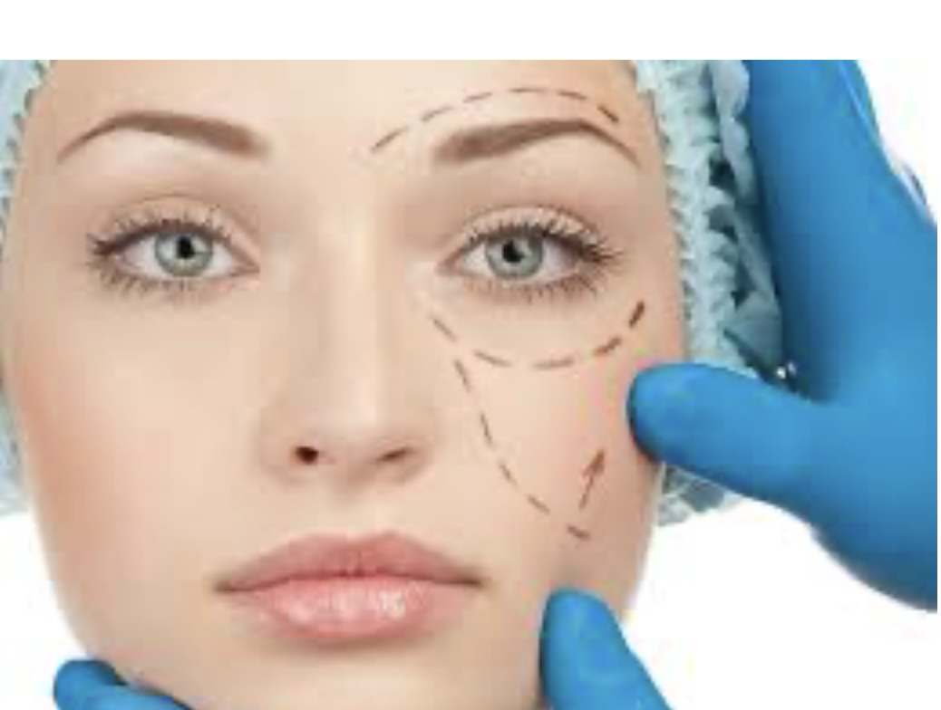 Best Debuting Sunken Cercles Treatment London 