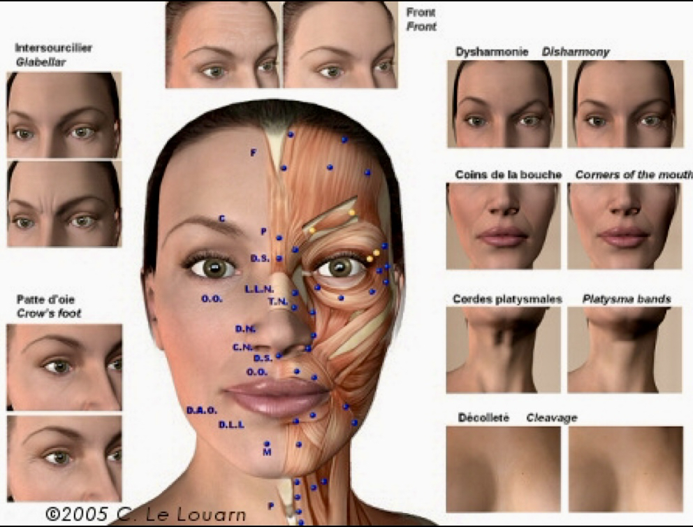 Best affordable Neck lift London 