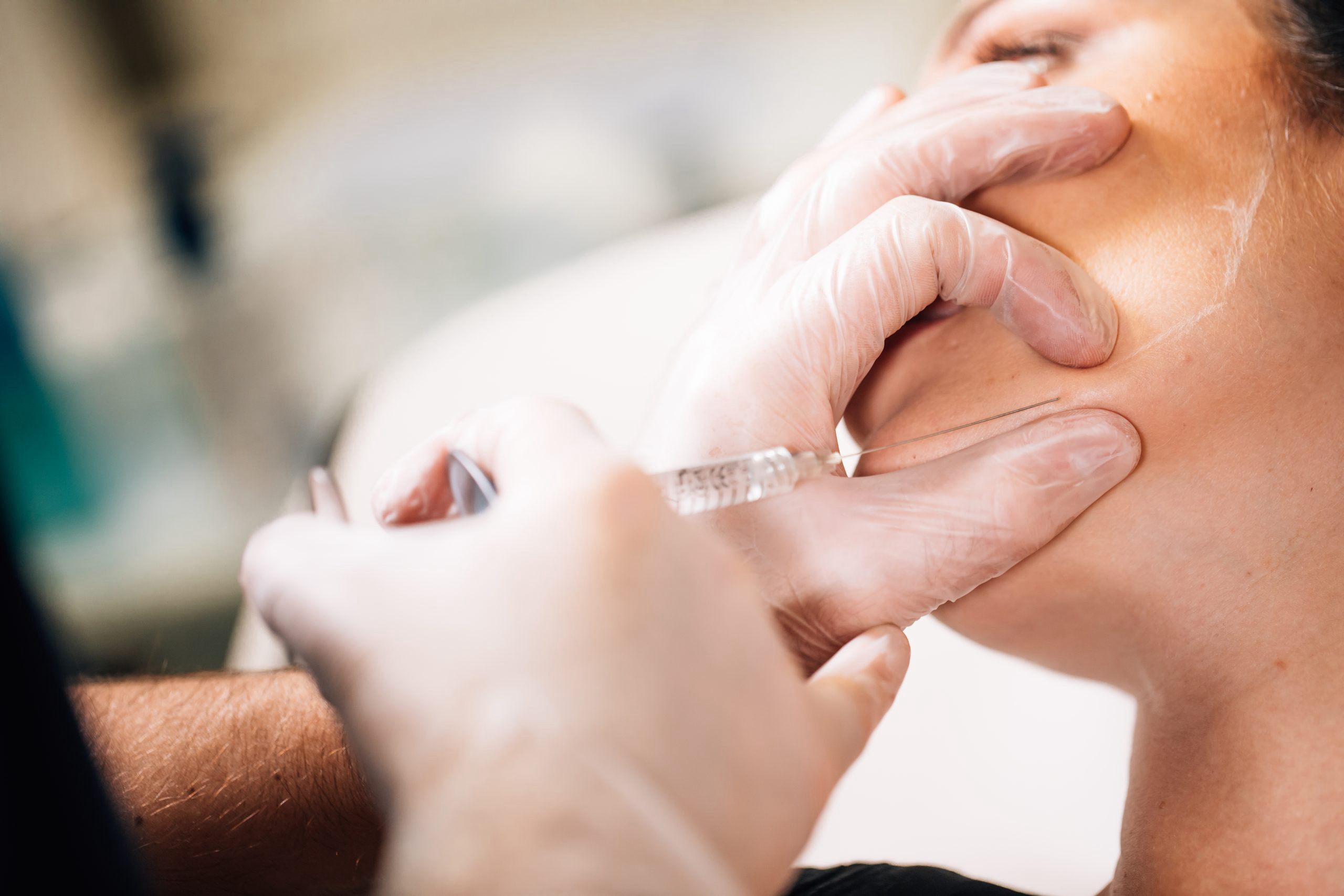 Nano, Micro, Fat Injections, Lipofilling, Grafting, London Paris, Regenerative Medicine