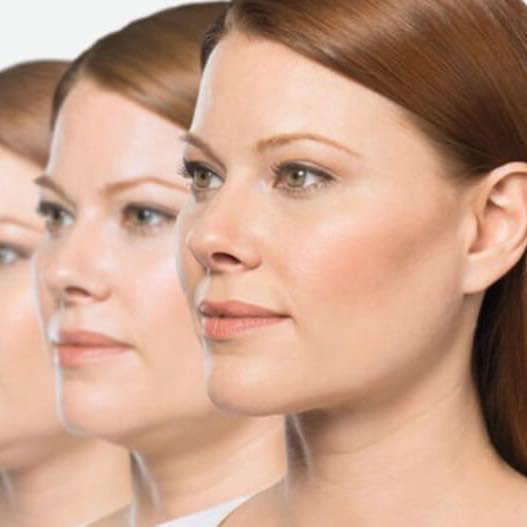 best belkyra London UK